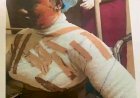 nightmare-500L student-attacked-fellow student with-boiling-water-in-benue