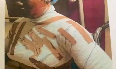 nightmare-500L student-attacked-fellow student with-boiling-water-in-benue